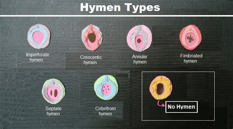 hymen porn|What Is the Hymen: Anatomy, Functions, Types and Care